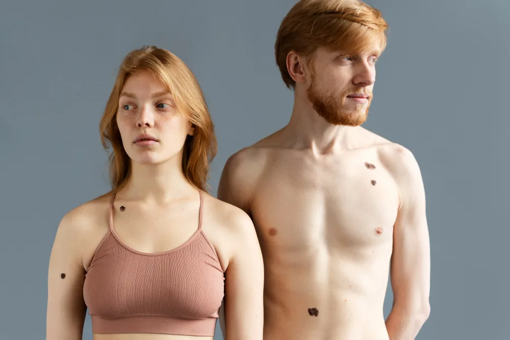 Boil vs Cyst: 11 Key Differences You Must Know for Better Skin Health