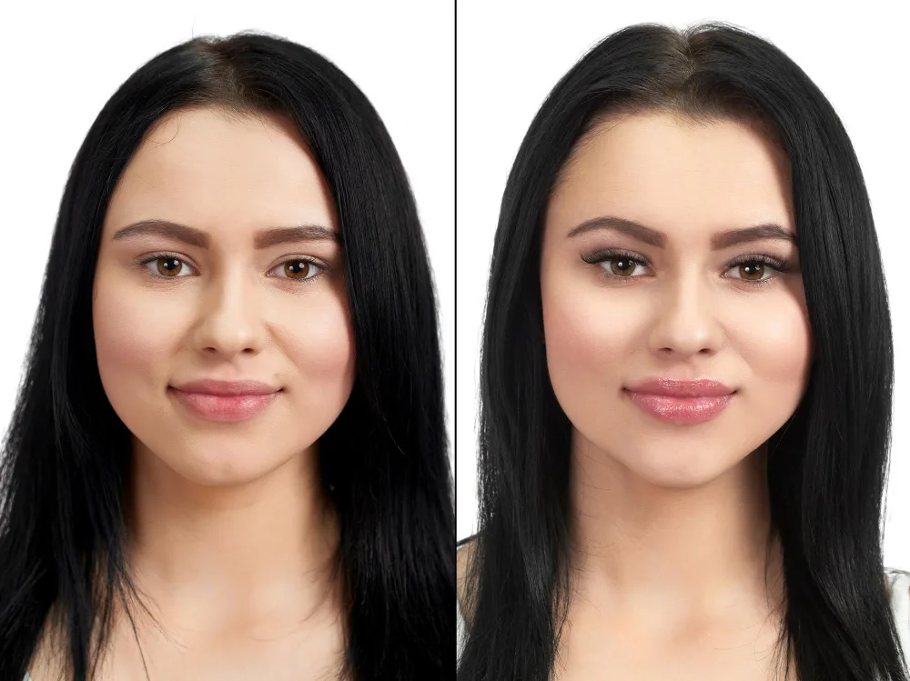 Lip Flip Before and After: 15 Real Insights You Must Know Before Trying It