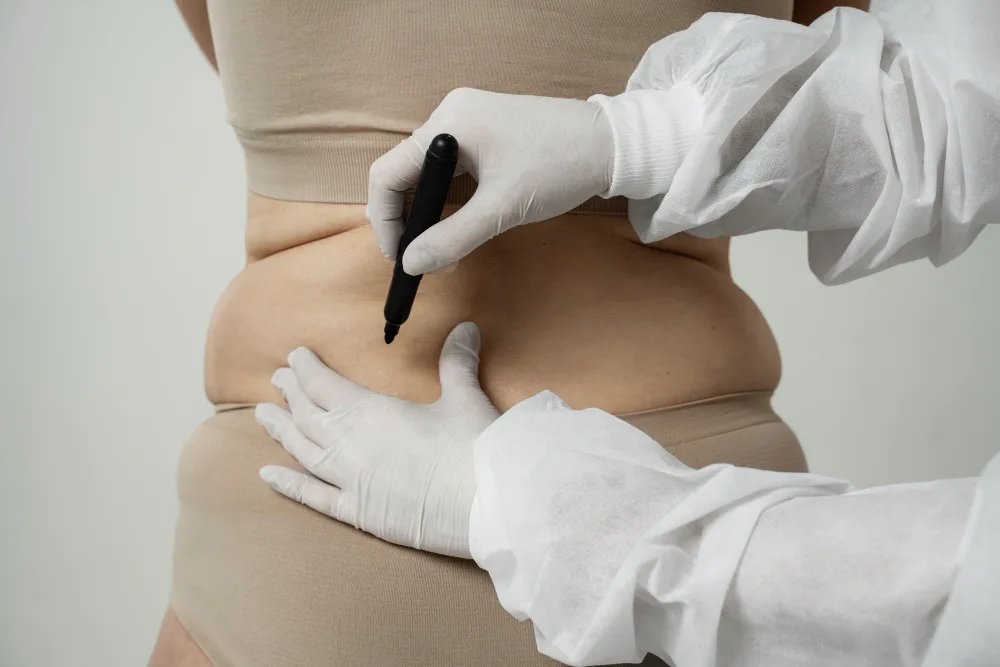 butt reduction surgery