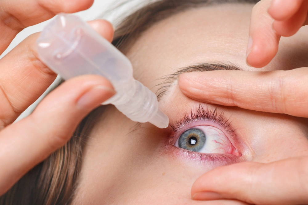 12 Important Things to Know: Can I Use Refresh Eye Drops After Cataract Surgery? (Complete Guide)