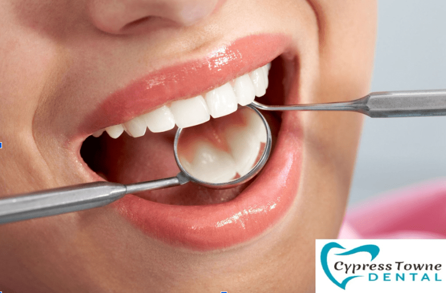 dental filling