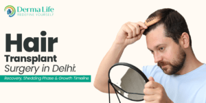 Hair Transplant: Cost, Techniques, Recovery & How to Choose a Clinic