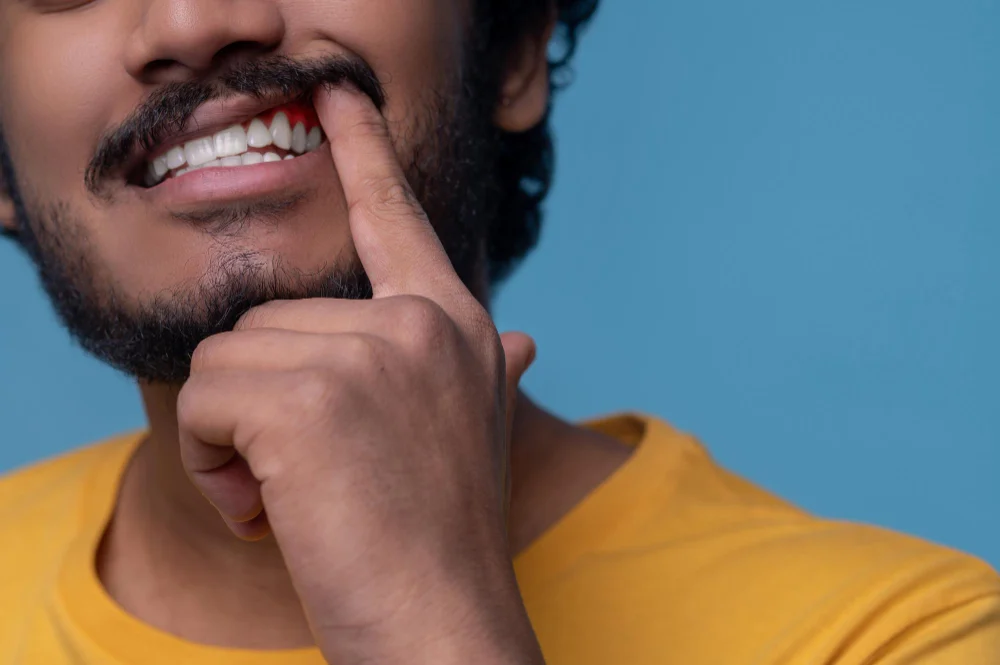 Why Are My Gums Detaching From My Teeth? Causes & Treatment