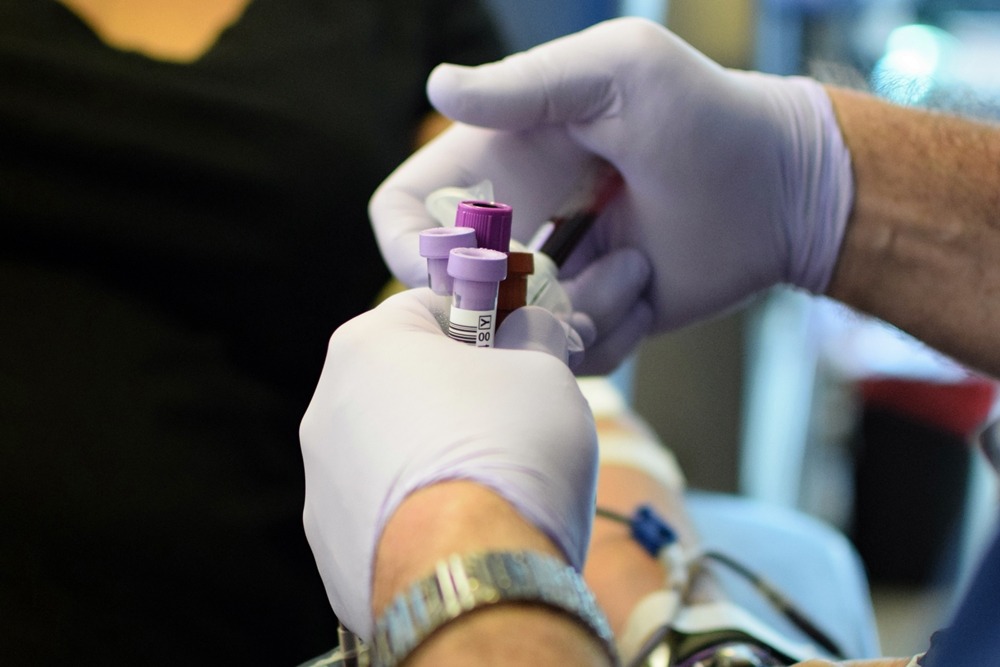 Blood Test for Vitamin and Mineral Deficiencies in Ann Arbor: What to Know