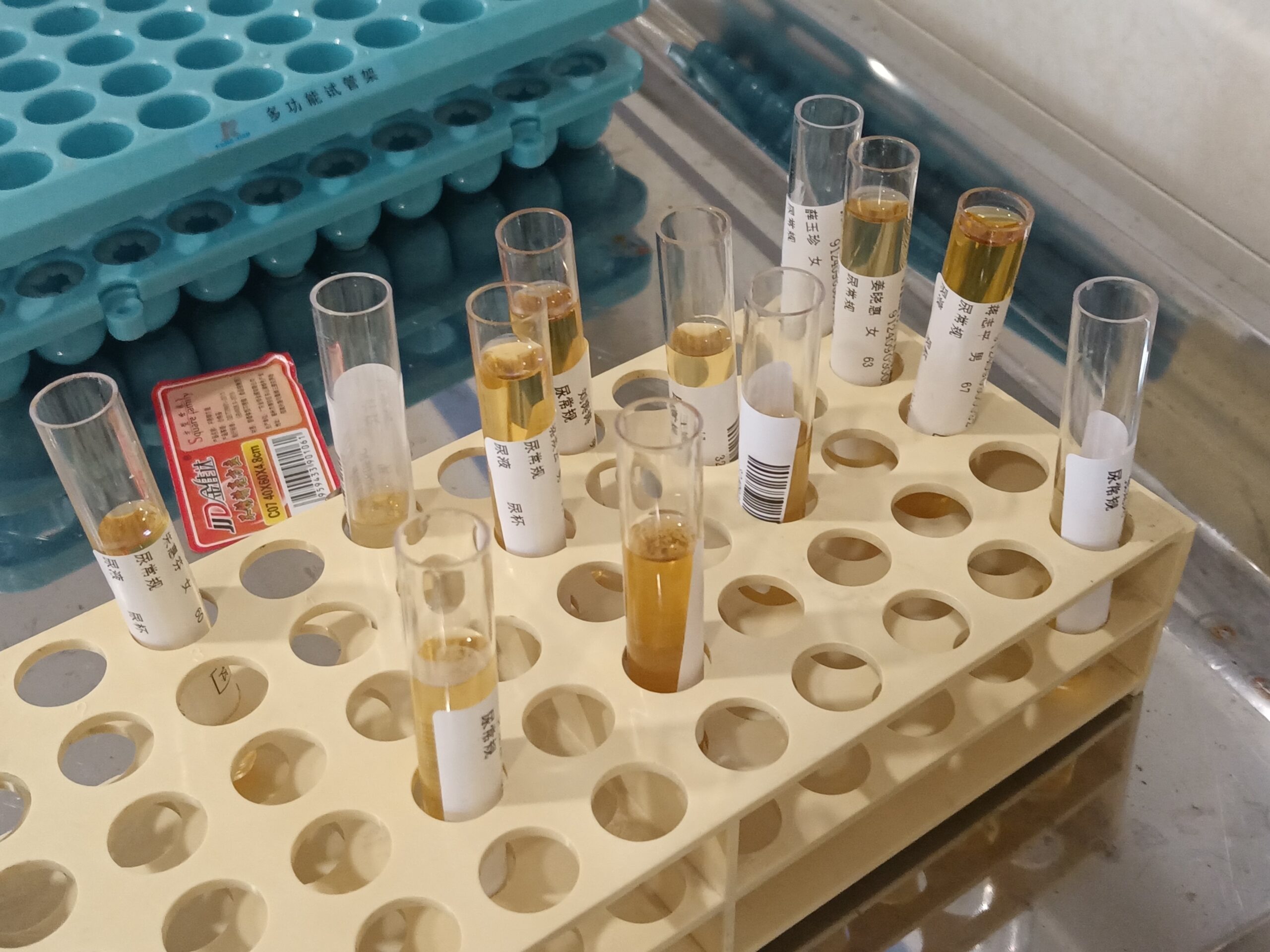 Urine test sample containers used for laboratory testing