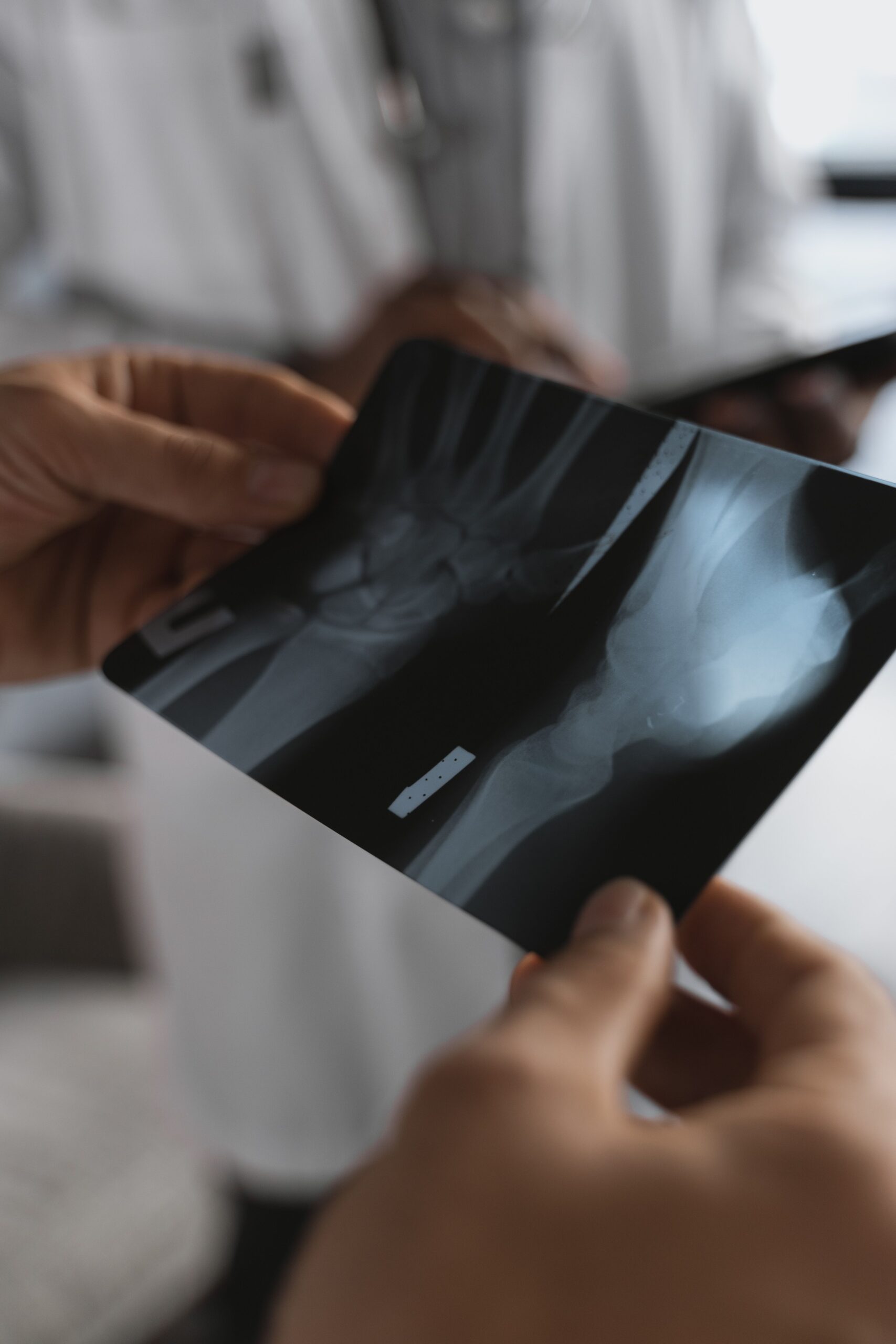 How to Tell If Your Wrist Is Broken? Signs, Symptoms & What to Do
